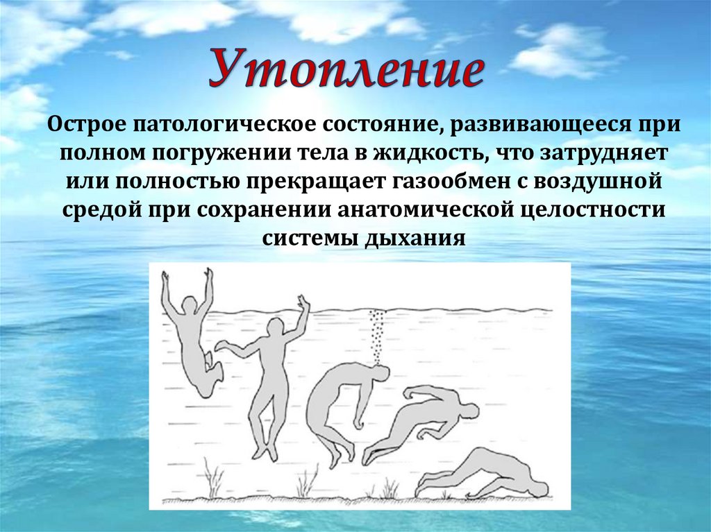 Закончить полностью. Утопление презентация. Первая помощь при утоплении презентация.