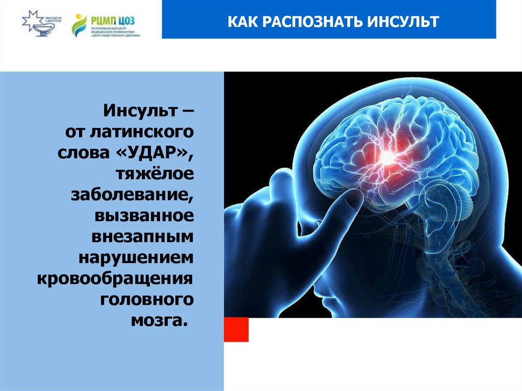 Инсульт картинки для презентации