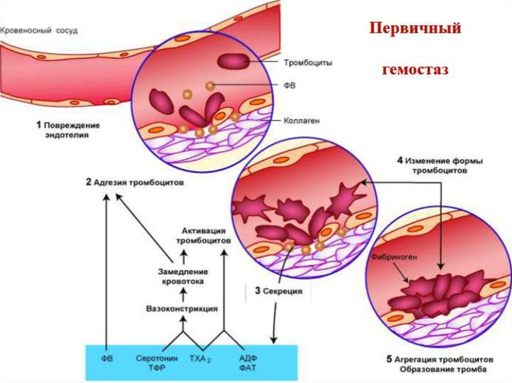 Тромбоциты и тромбы. Тромбоцитарный механизм гемостаза. Механизм сосудисто-тромбоцитарного гемостаза схема. Свертывание крови коагуляционный гемостаз. Схема свертывания крови образование сгустка.