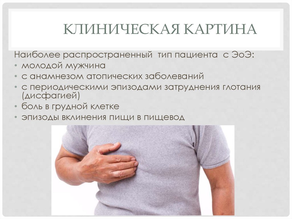 Клиническая картина