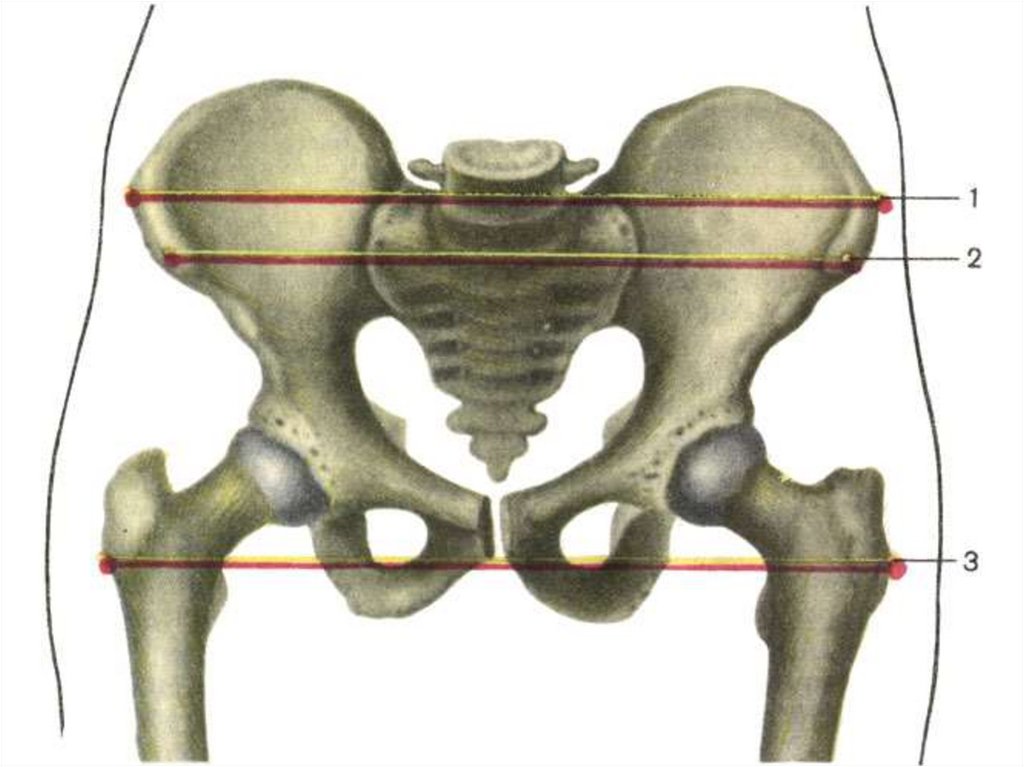Расстояние между костями. Малый таз скелет. Анатомия костный женский таз. Гребневая дистанция женского таза. Женский таз тазовая кость.