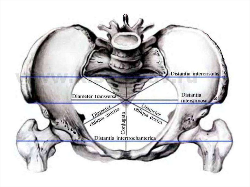 Акушерские размеры таза на рисунке