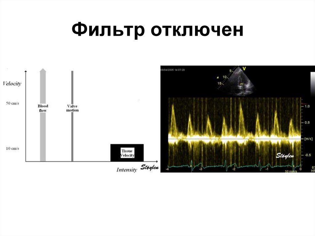 Фильтр отключен