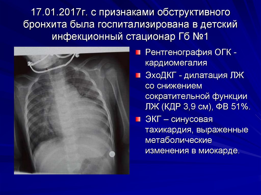 17.01.2017г. с признаками обструктивного бронхита была госпитализирована в детский инфекционный стационар Гб №1