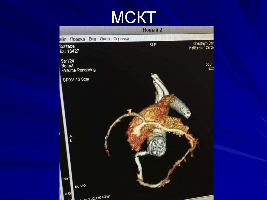 МСКТ