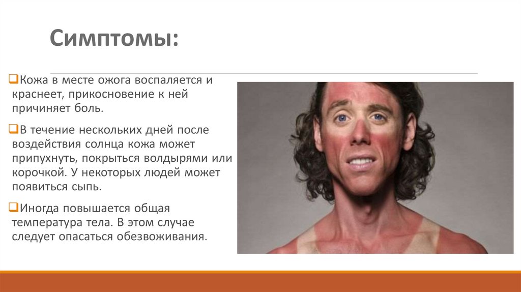Профилактика солнечных ожогов - online presentation