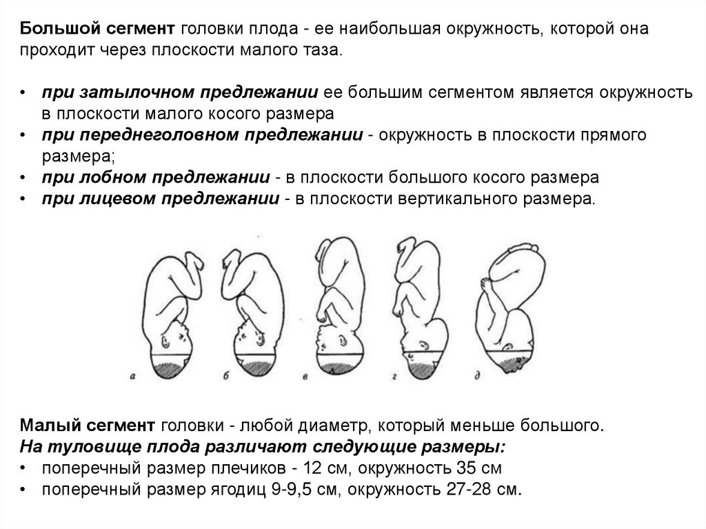 Презентация головка плода