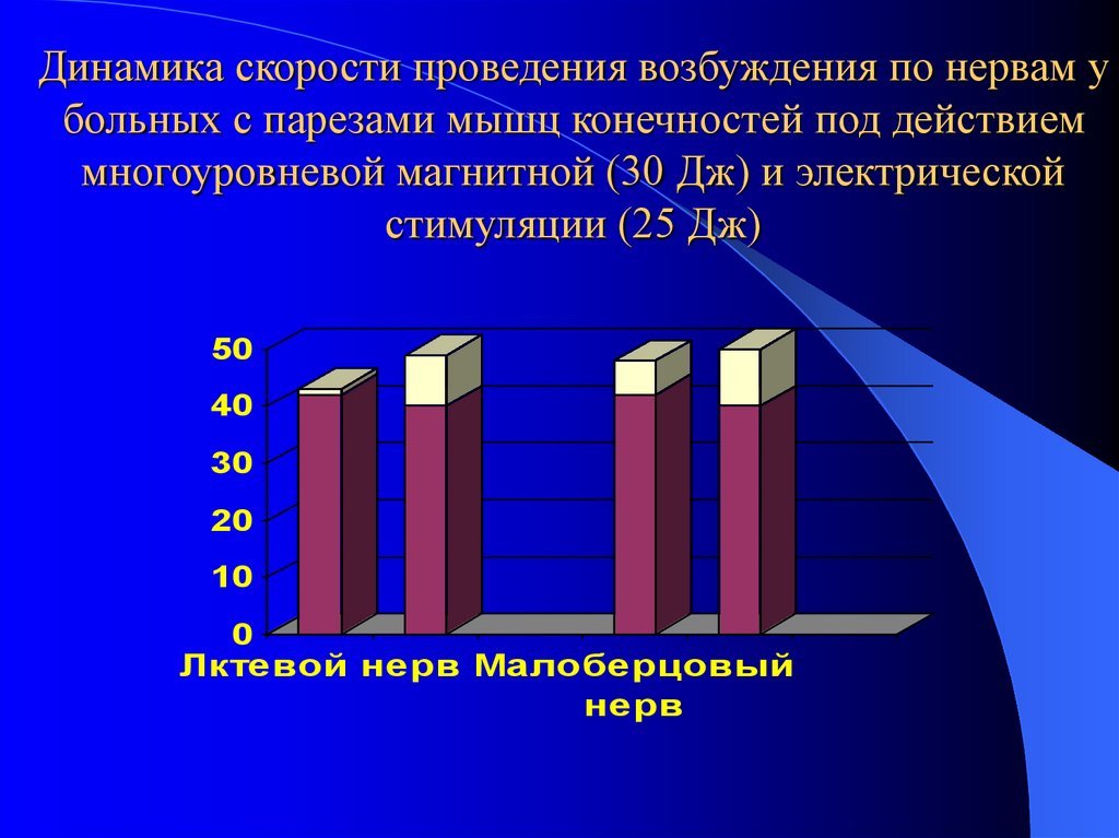 Скорость динамики