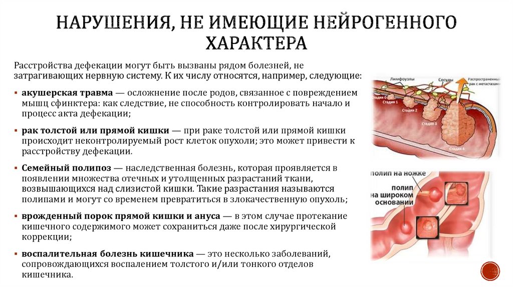 Нарушения, не имеющие нейрогенного характера