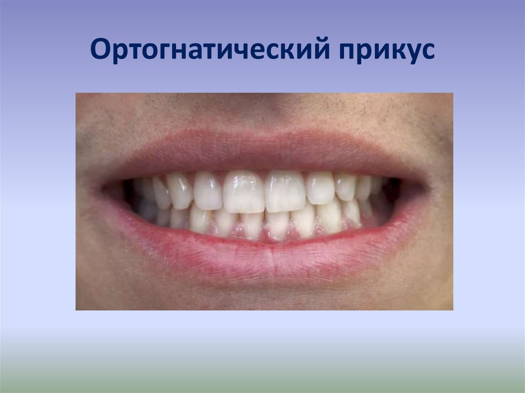 Какой должен быть правильный прикус у человека. Ортогнатический прикус зубы. Правильный ортогнатический прикус. Ортогнатический, прогенический, прямой прикус. Привкус ОРТОГНОТИЧЕСКИЙ.