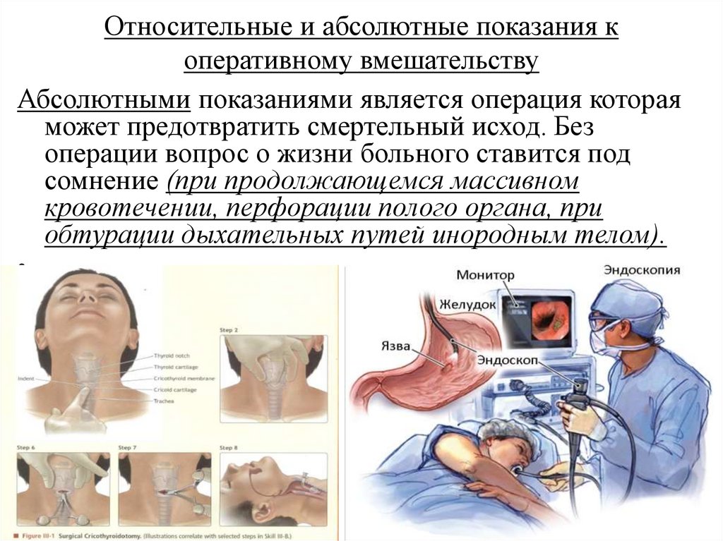 Оперативная операция