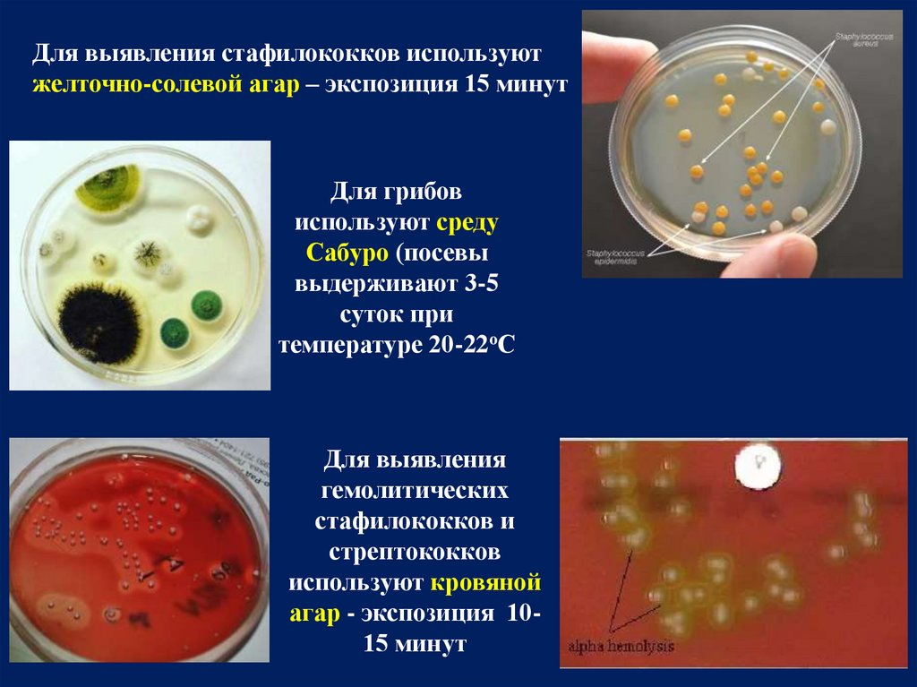 Staphylococcus aureus среда. Среда желточно солевой агар Чистовича. Желточно солевой агар микробиология. Стафилококк на желточно солевом агаре. ЖСА питательная среда.