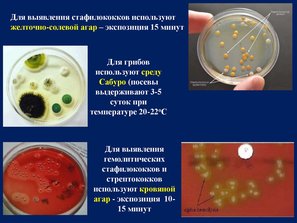 Осуществляется на среде. Среда желточно солевой агар Чистовича. Желточно солевой агар для стафилококков. Желточно солевой агар микробиология. Желточно-солевой желточно-солевой агар.