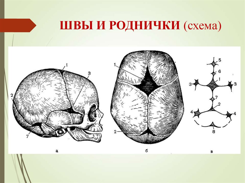 Роднички доношенного ребенка. Роднички схема. Роднички черепа. Роднички у детей анатомия. Форма большого родничка.