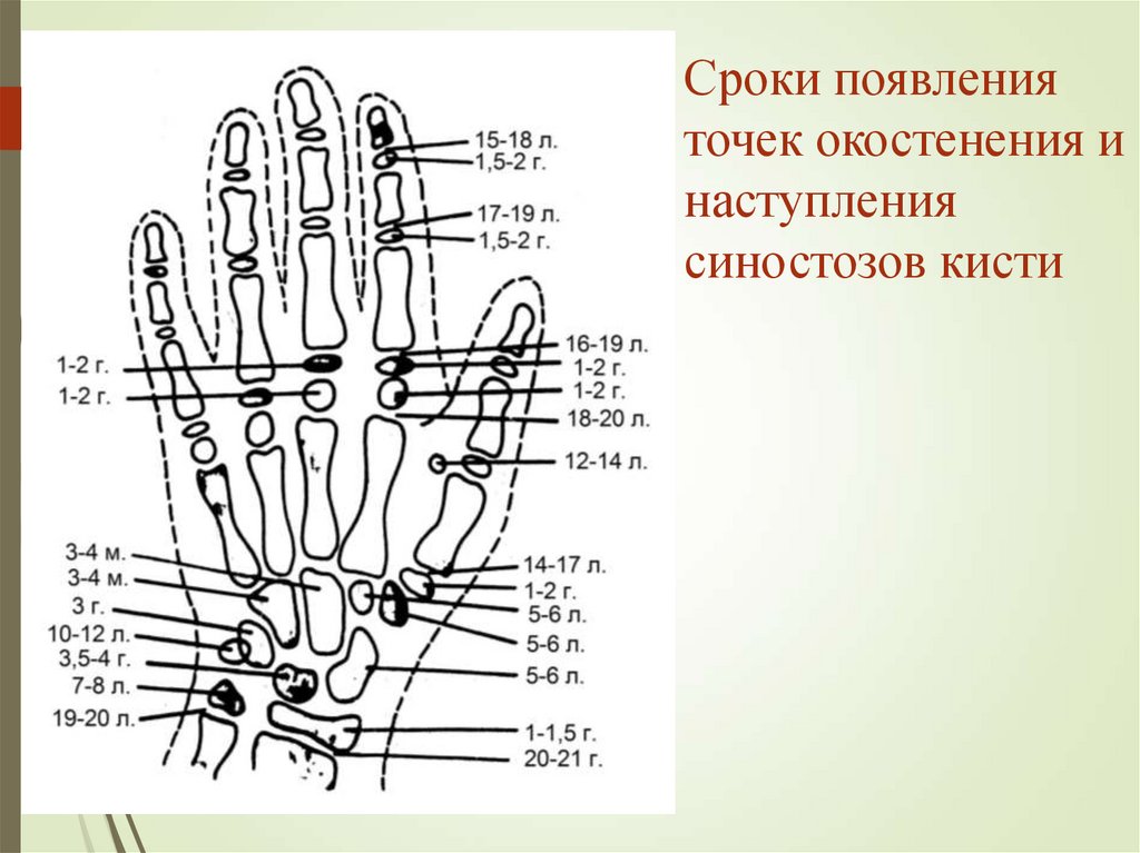 Точка появления. Костный Возраст рентген кисти. Костный Возраст по рентгенограмме кисти 14 лет. Костный Возраст 12 лет рентген. Оценка костного возраста по рентгенограмме кисти.