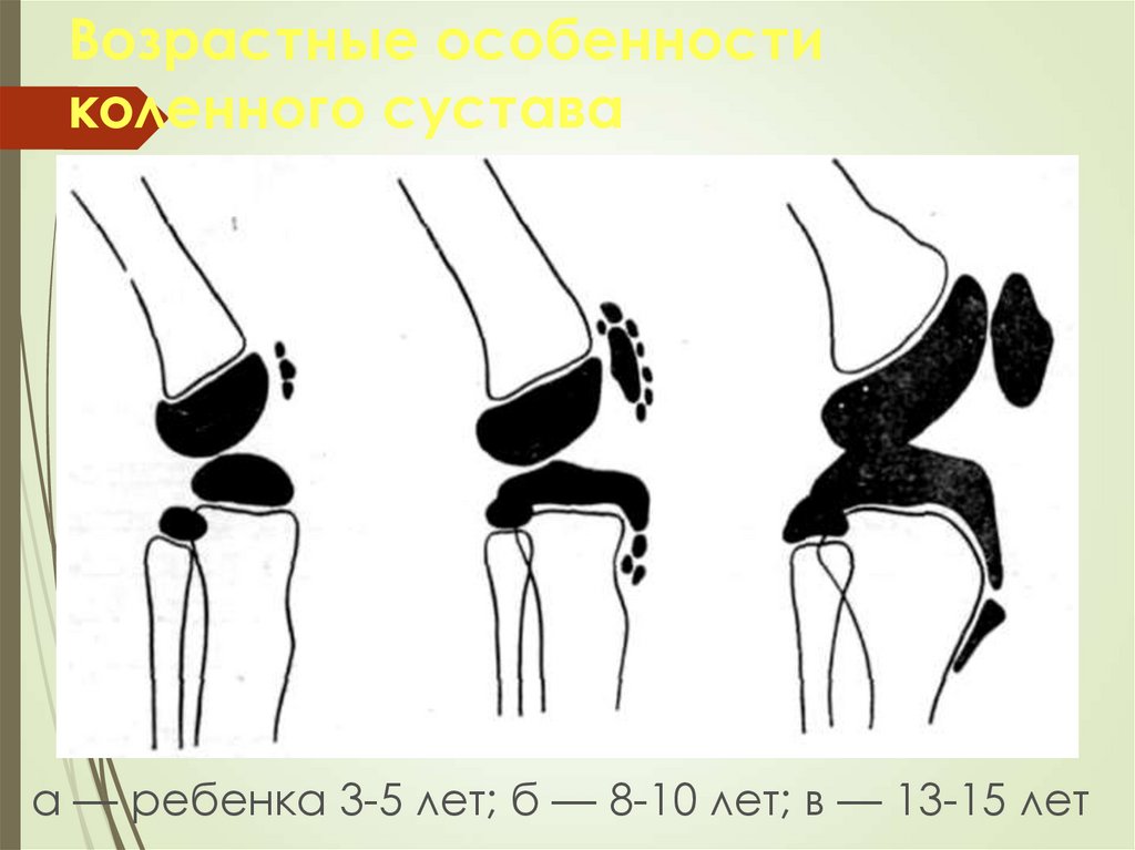 Развитие суставов. Возрастные особенности коленного сустава. Особенности суставов у детей. Возрастные особенности коленных суставов у детей. Схема коленного сустава у детей.