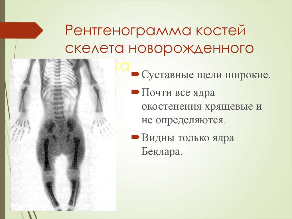 Кости новорожденного. Рентгенограмма костей скелета. Рентгеноанатомия скелета. Ядро окостенения Беклара. Рентгенограмма скелета новорожденного.