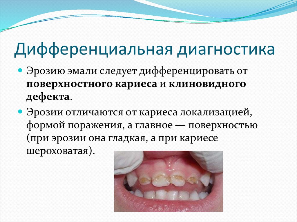 Дифференциальная диагностика