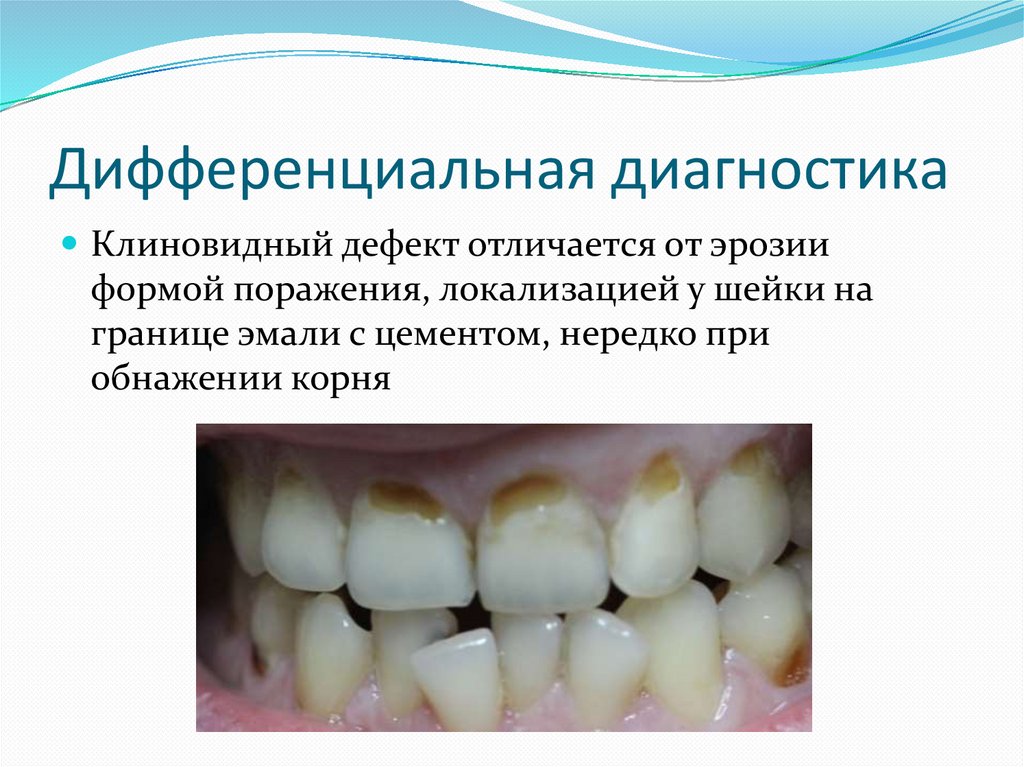 Дифференциальная диагностика