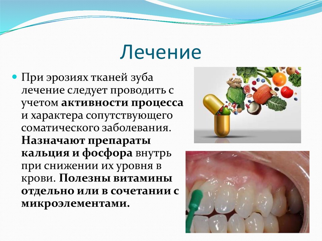 Эрозия зубов - презентация онлайн