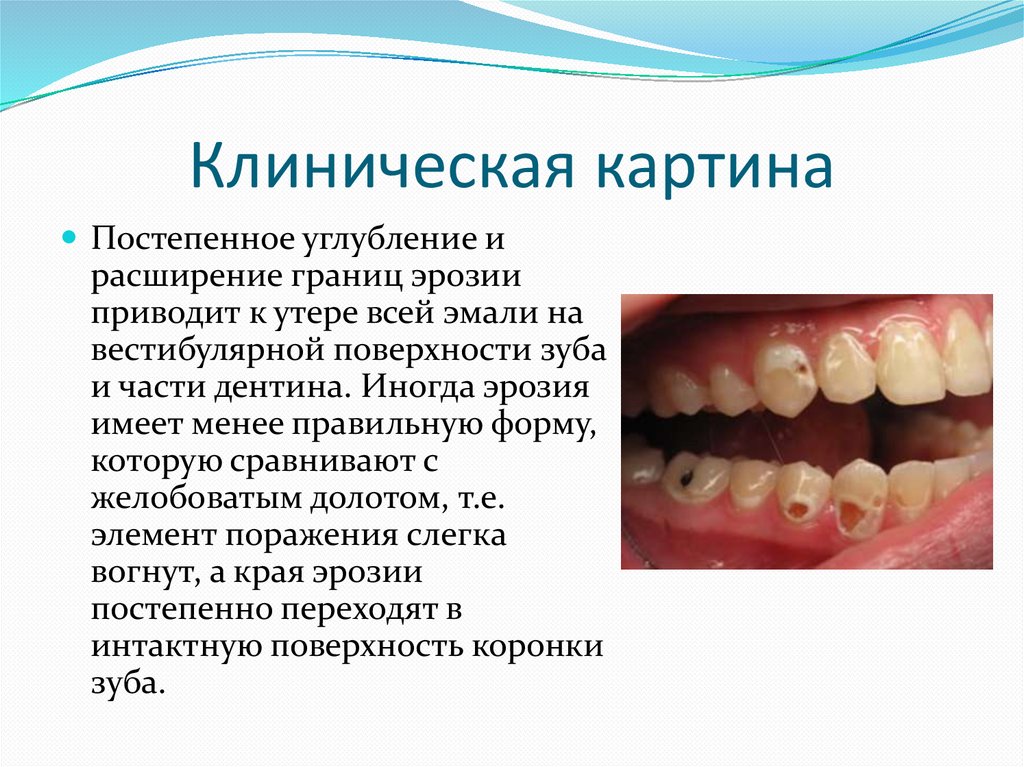 Клиническая картина