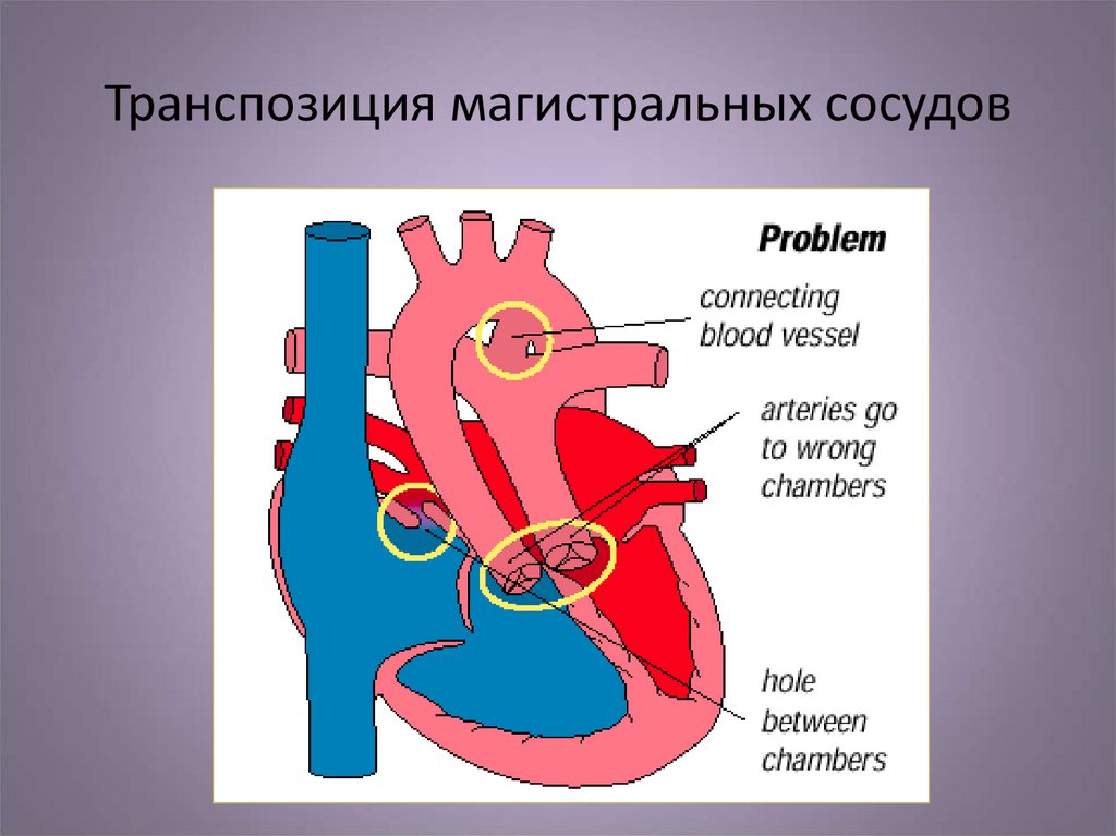 Магистральные сосуды это