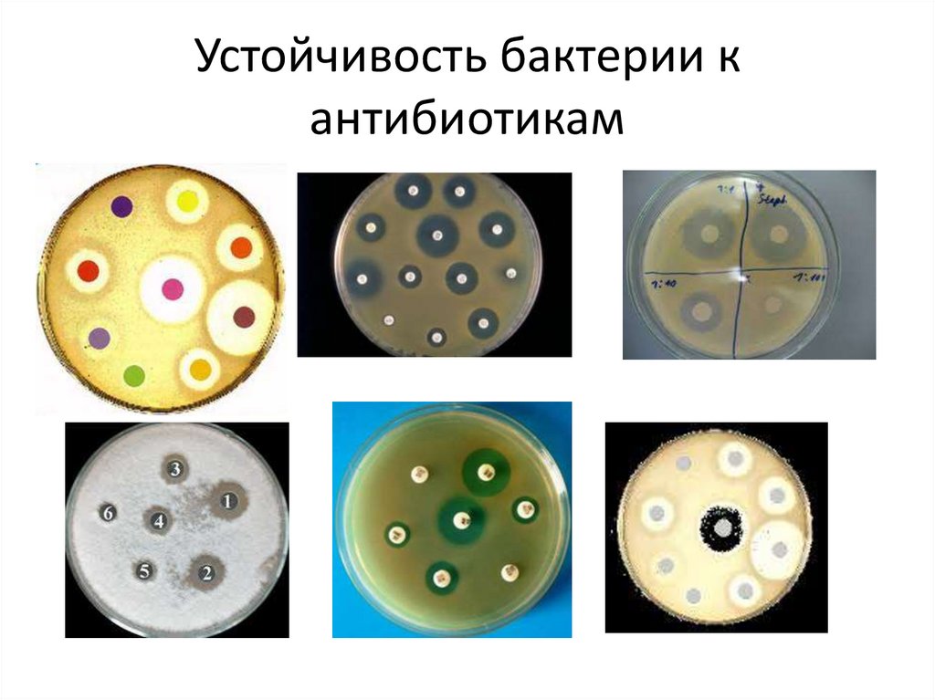 Резистентность бактерий к антибиотикам