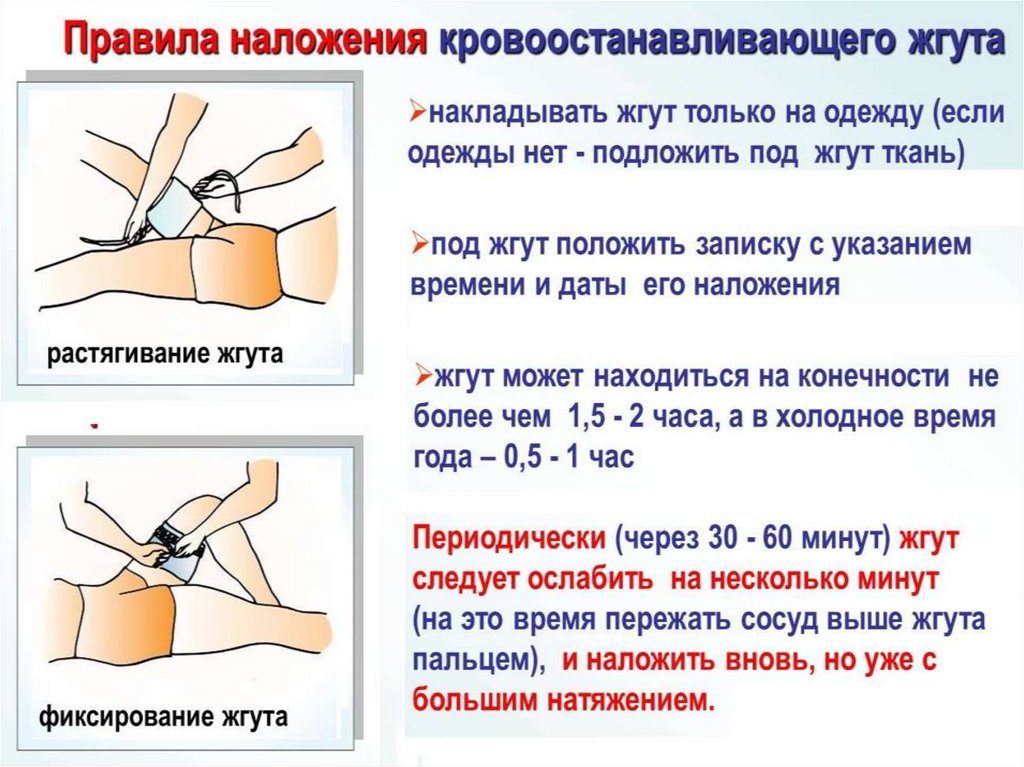 Оказание первой помощи при наружном кровотечении презентация по обж 7 класс