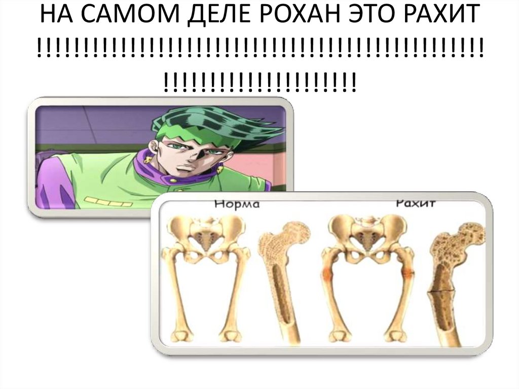 НА САМОМ ДЕЛЕ РОХАН ЭТО РАХИТ !!!!!!!!!!!!!!!!!!!!!!!!!!!!!!!!!!!!!!!!!!!!!!!!!!!!!!!!!!!!!!!!!!!!!