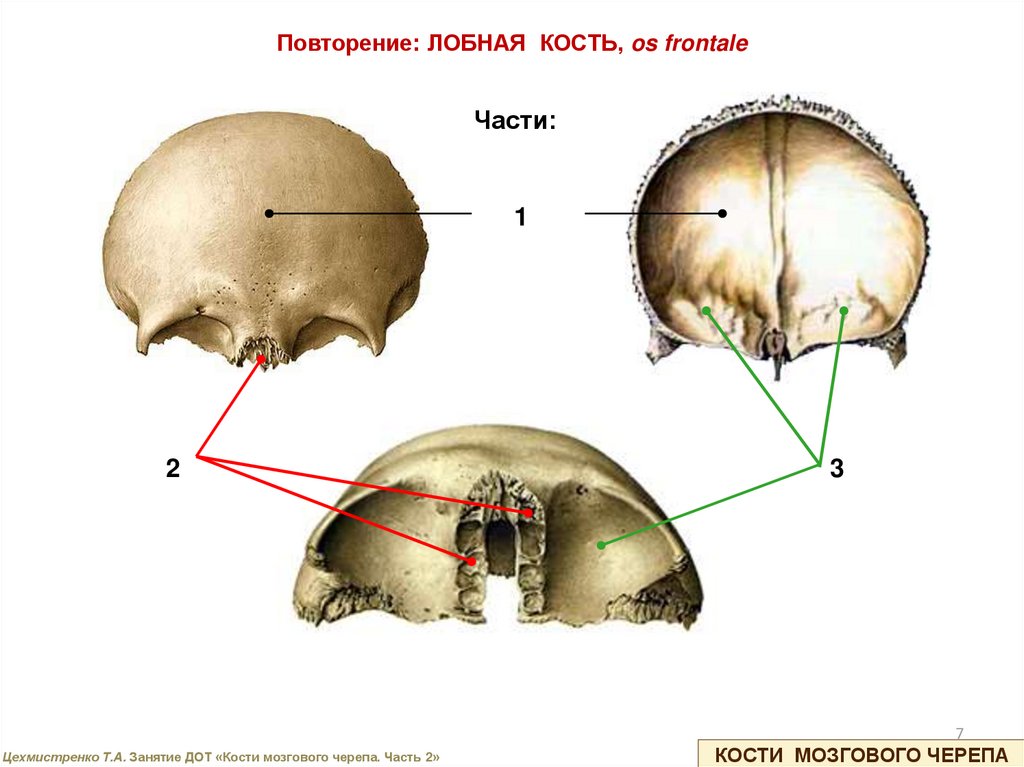 Лобная отдел скелета. Мозговой отдел черепа лобная кость. Кости мозгового черепа анатомия лобная кость. Анатомия лобной кости черепа. Кости мозгового черепа: лобная, затылочная, теменная..