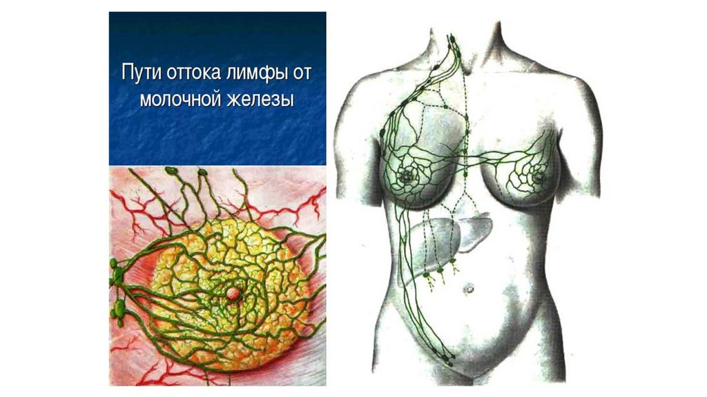 Лимфатические узлы груди. Лимфатическая система молочной желез. Сигнальные лимфатические узлы молочной железы. Анатомия молочной железы лимфоотток. Пути оттока лимфы от молочной железы схема.