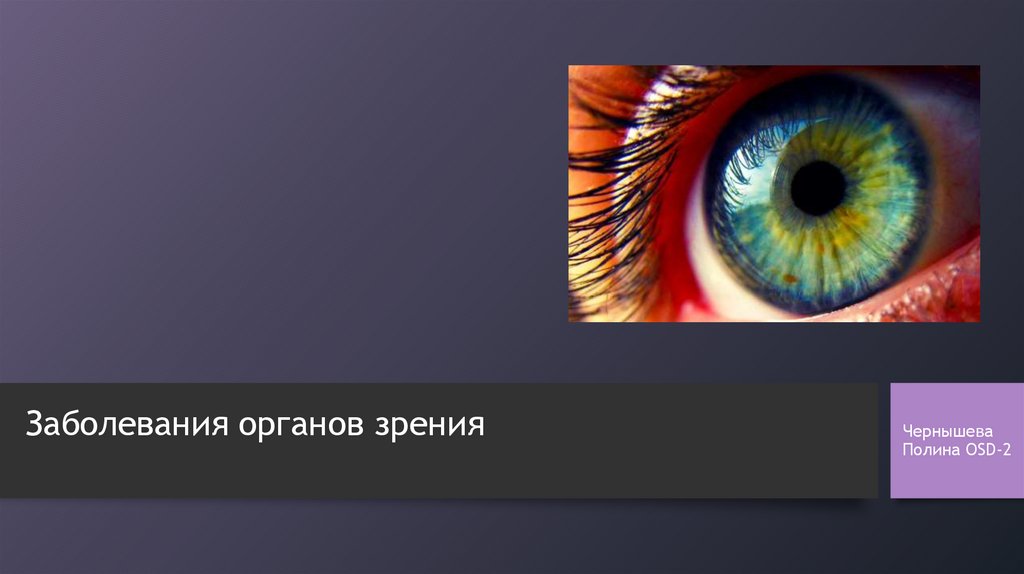 Заболевания органов зрения презентация 8 класс