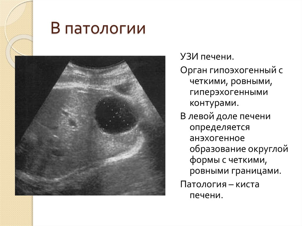 В патологии