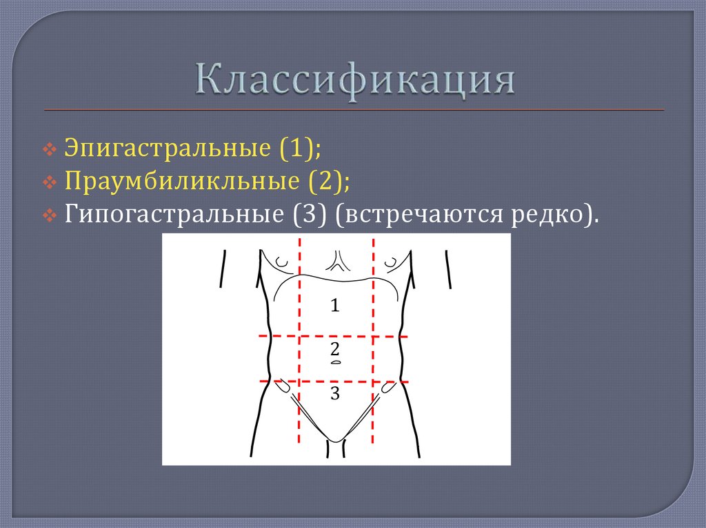 Грыжа линии. Грыжа белой линии живота классификация. Грыжа белой линии живота схема. Грыжи белой линии живота презентация. Грыжа срединной линии живота.