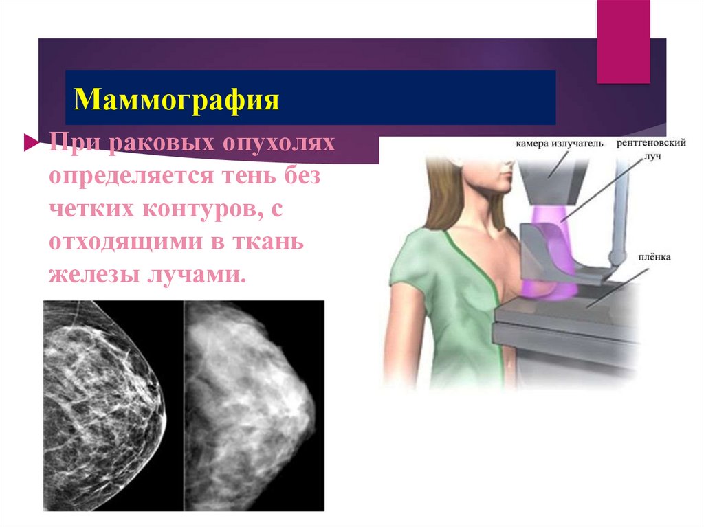 Маммография обязательно. Маммография. Маммография молочных желез. Современная маммография молочных желез. Маммография молочных желез маммограф.