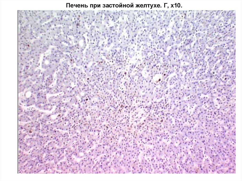 Печень при застойной желтухе. Г, х10.