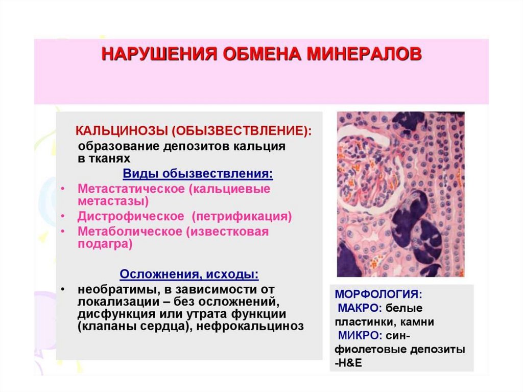 Изменения в тканях. Нарушение обмена кальция патанатомия. Нарушения минерального обмена патанатомия. Метаболическое обызвествление исход.