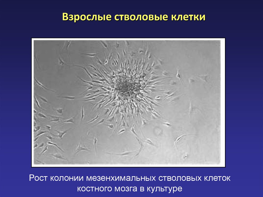 Мезенхимальные стволовые клетки. Мезенхимальные (стромальные) стволовые клетки. Мезенхимальные клетки. Мезенхимальные стромальные клетки. Мезенхимальные стволовые клетки костного мозга.