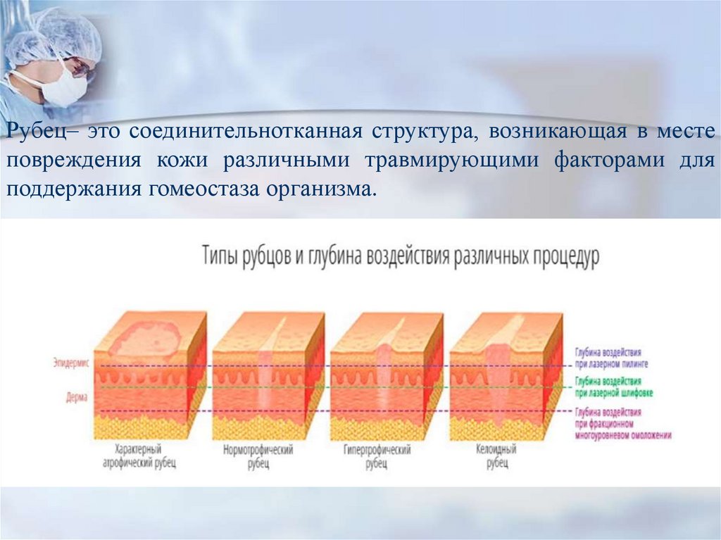 Рубцовых изменений. Стадий заживления РАН вторичным натяжением. Заживление РАН грануляционная ткань. Этапы заживления первичным и вторичным натяжением. Процесс заживления РАН соединительной тканью это что.