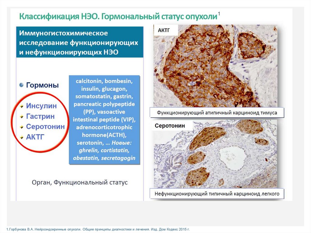 Нейроэндокринные опухоли презентация