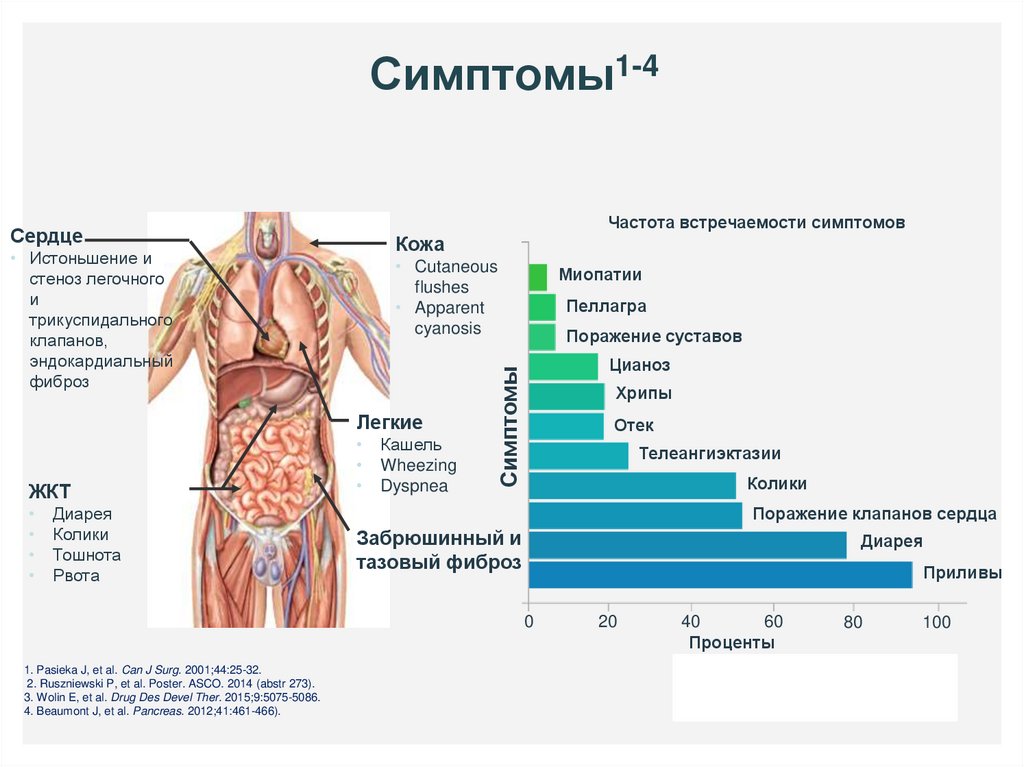 Нейроэндокринная опухоль симптомы