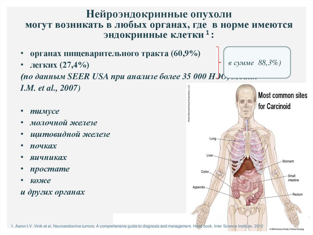 Нейроэндокринные опухоли презентация