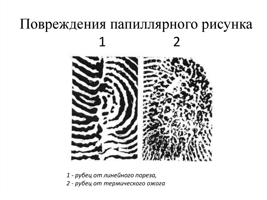 Чем обусловлен папиллярный рисунок кожи