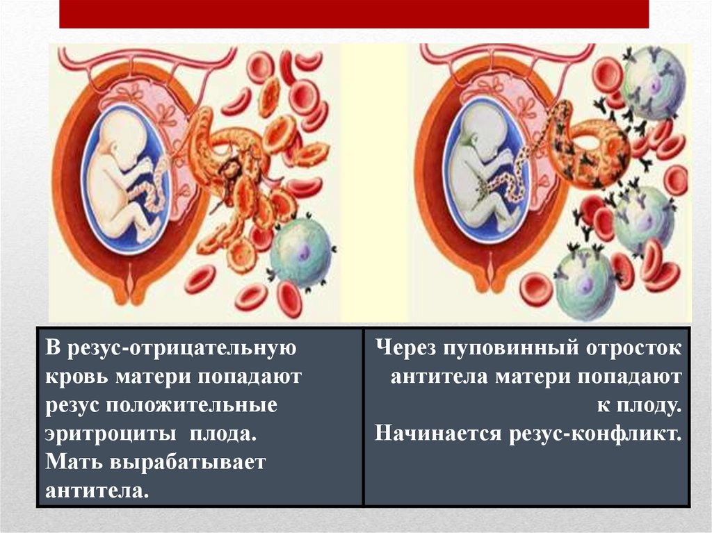 Кровь 1 отрицательная беременность