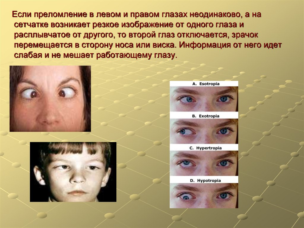Гигиена зрения предупреждение глазных. Изображение в левом и правом глазу. Предупреждение глазных инфекций 8 класс. Гигиена зрения картинки. Гигиена зрения 8 класс.
