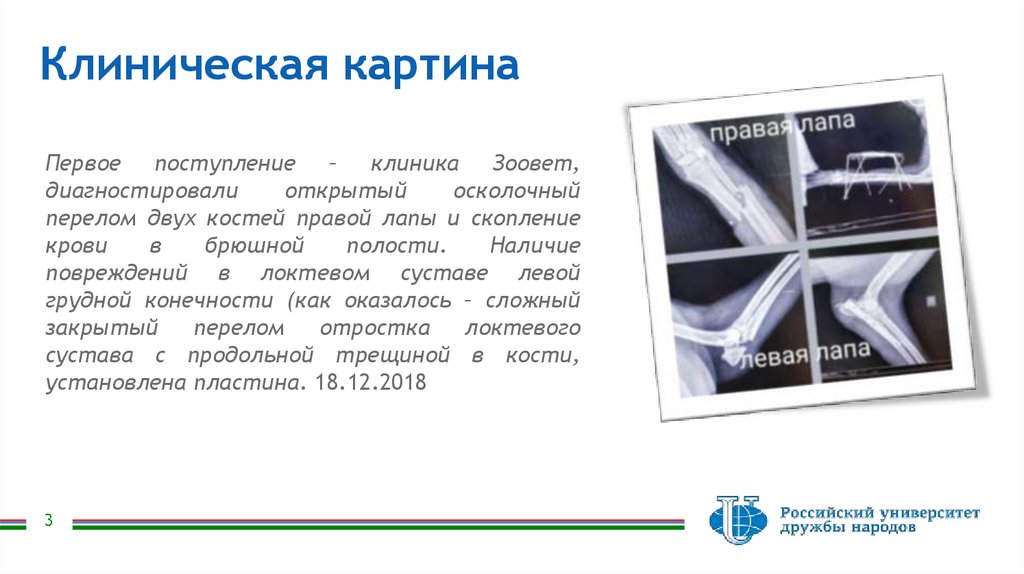 Клиническая картина