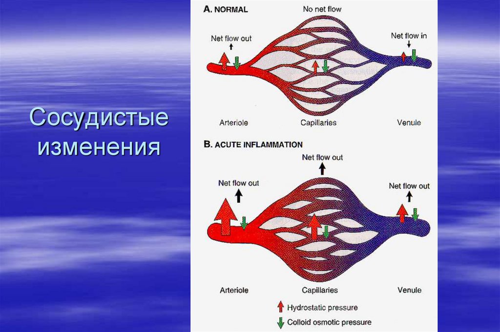 Сосудистые изменения