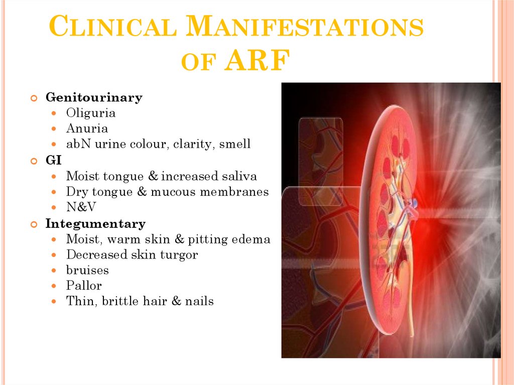 Clinical Manifestations of ARF