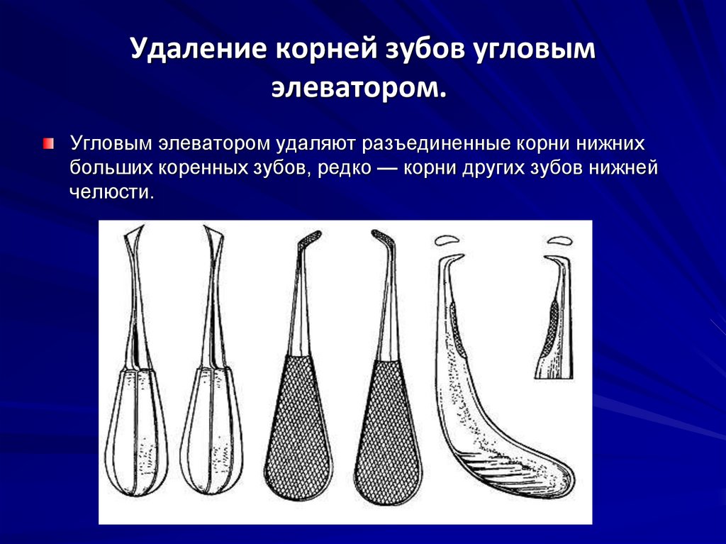 Для получения раздельного изображения корней коренных зубов центральный луч должен иметь направление