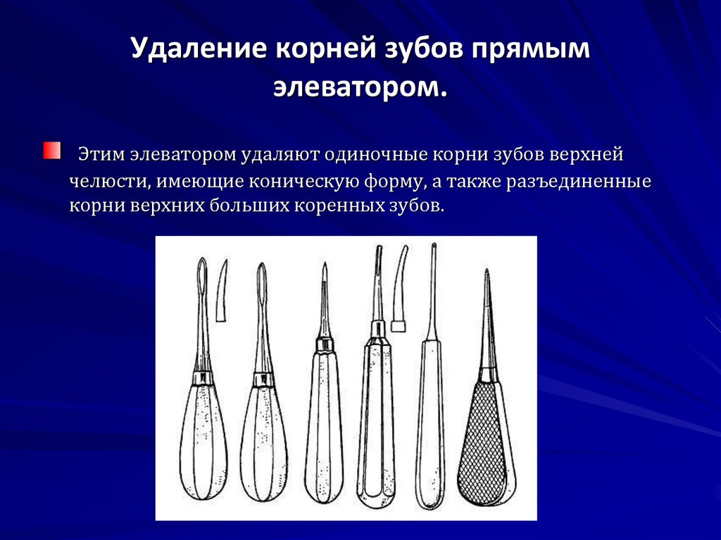 Резекция верхней челюсти презентация